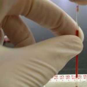 Hematocrit în sângele femeilor