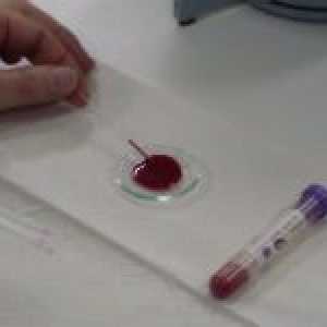 Motivele pentru hematocritul crescut în sânge
