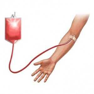 Transfuzie de sânge (transfuzie de sânge): Provocări și soluții, lectură, deținerea, ingrediente