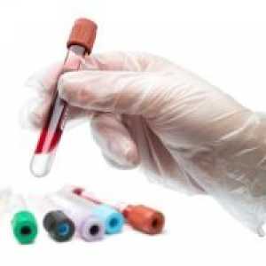 Un test de sânge pentru tuberculoză la copii: acuratețea și posibilitatea