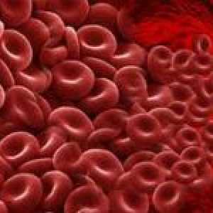 Hipercoagulabilitatea sângelui și tratamentul acesteia