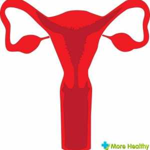 Hiperplazie endometrială: cauzele principale simptome, răzuire
