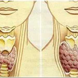 Hipotiroidismul - o boala care se dezvolta atunci când există o producție insuficientă de hormoni…