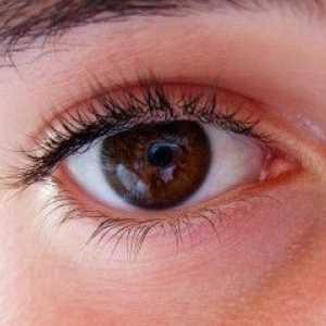 Presiune oculara: semne de creștere, simptome și tratament.