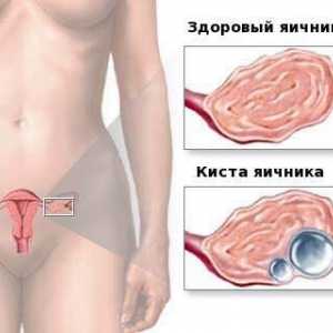 Natura durerii dureri în abdomen la bărbați și femei