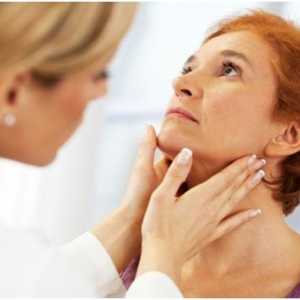 Tiroidita cronica lui - nodulare tiroidiene: Simptome, diagnostic și tratament