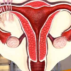Inflamația cronică a trompelor uterine: tratament stationar