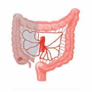 Ischemie miocardică și intestinului: cauze, simptome, diagnostic, tratament, consecințe