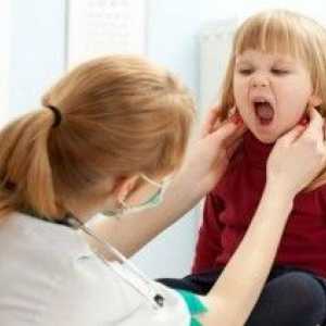 Mononucleoza infecțioasă: simptomele în copil. Opinia Dr. Komarovsky
