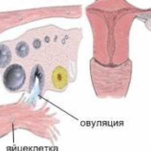 Informații cu privire la modul de a găsi ginecologi gestaționale
