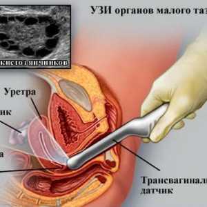 Întrebări intime: Este posibil de a face cu ultrasunete in timpul menstruatiei? 2