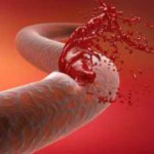Sângerare în special gastro-intestinale