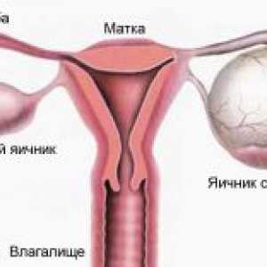 Ovarele in timpul menstruatiei