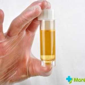 Cauzele urină alb la bărbați și femei