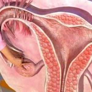 Tratate eficient remedii populare ovare polichistice? Aflam cauzele bolii.