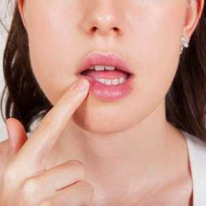 Medicamente eficiente impotriva herpesului pe buze