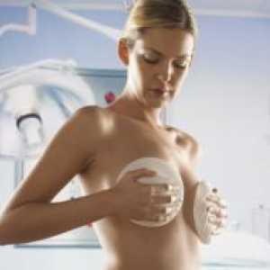 Endoproteze glandei mamare ca metodă de reconstrucție după mastectomie