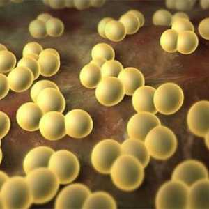 Cum să se ocupe cu Staphylococcus aureus in intestin?