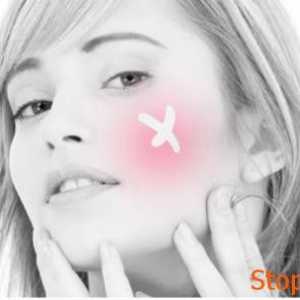 Cum se utilizează gropi de unguent de la acnee?