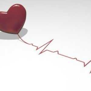 Cum de a trata aritmii cardiace?