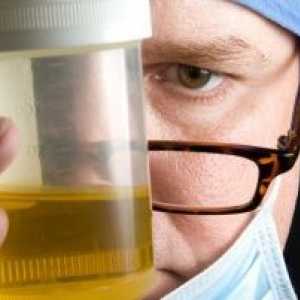 Cum de a colecta urina de zi cu zi: Pregătirea pentru analiza și colectarea materialului