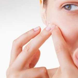 Cum se utilizează acid salicilic pentru acnee