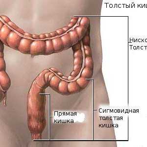 Procesul de inflamație de colon