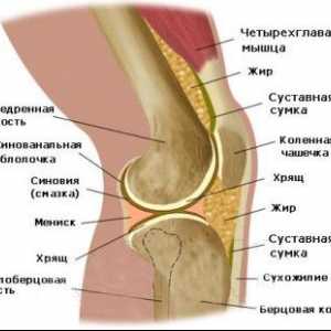 Care sunt simptomele artritei genunchiului