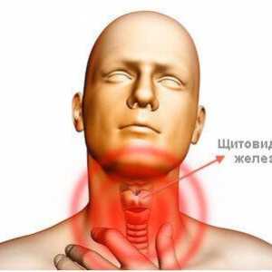 Simptome ale bolii tiroidiene la bărbați ca un manifest