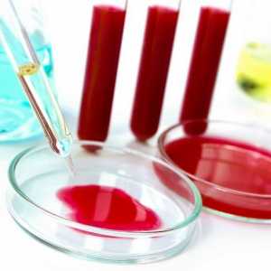 Cum să luați un test de sânge pentru Giardia
