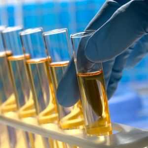Cum să luați și care identifică analiza chimică-toxicologică a urinei?