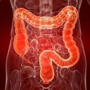 Cum de a identifica cancerul de colon?