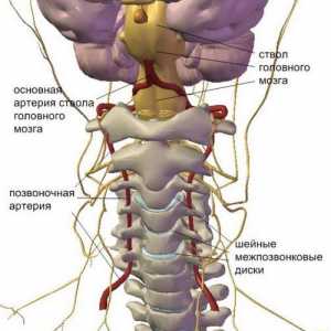 Cum de a trăi cu sindromul arterei vertebrale