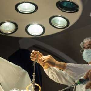 Ce operații sunt prezentate în varicocel