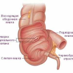 Care sunt simptomele unei tumori cecului?
