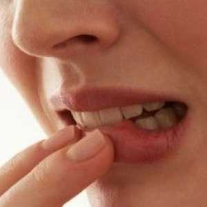 Candidoză orală: simptome și tratament