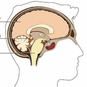 Chist epifiză (glanda pineala) creier