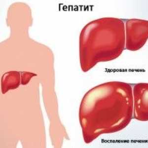 Clinica Hepatita la: forme acute și cronice