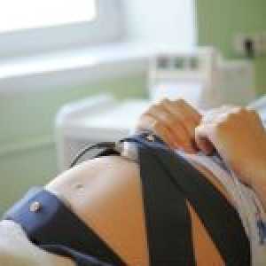CTG fat in timpul sarcinii (cardiotocografia)