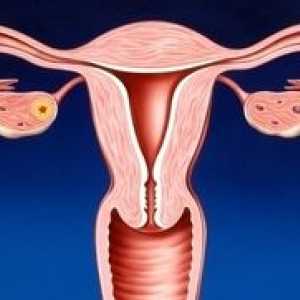 Tratamentul de remedii populare cervicita