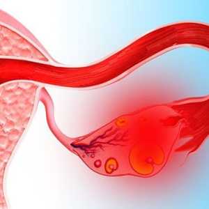 Menstrelor după apoplexie ovarian 2