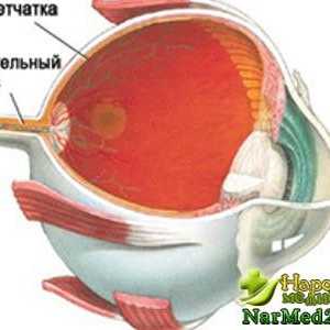 Metode de tratament clasic si popular al distrofiei retiniene