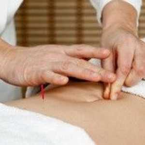 Pot folosi acupunctura în tratamentul infertilității?