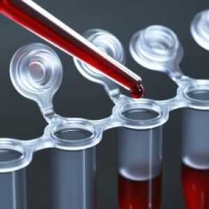 Recomandare pentru un test de sânge: forma și cerințele pentru completarea acestuia