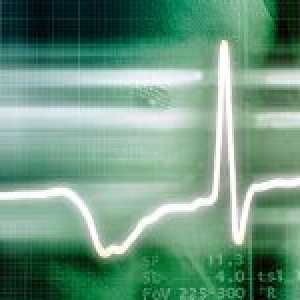 Tipuri de tulburări de ritm cardiac și tratamentul lor