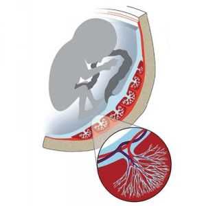 Flux afectata de sange in arterele uterine, cordon ombilical, placenta in timpul sarcinii (nmpk)