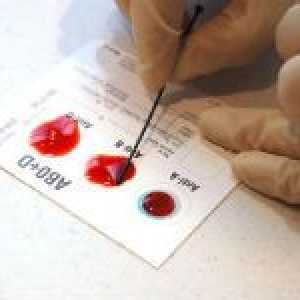 Compatibilitatea și incompatibilitatea grupelor sanguine și a factorilor rhesus