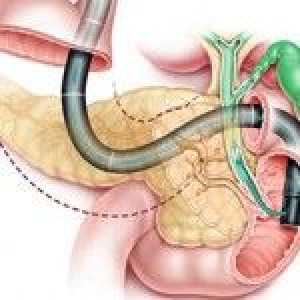 Necroza pancreasului: o așteptare pentru prognoza?