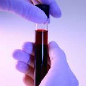 Norma neutrofilelor din sânge la copii și cauzele abaterilor