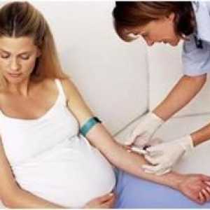 Norma TSH nivelul de hormon in timpul sarcinii